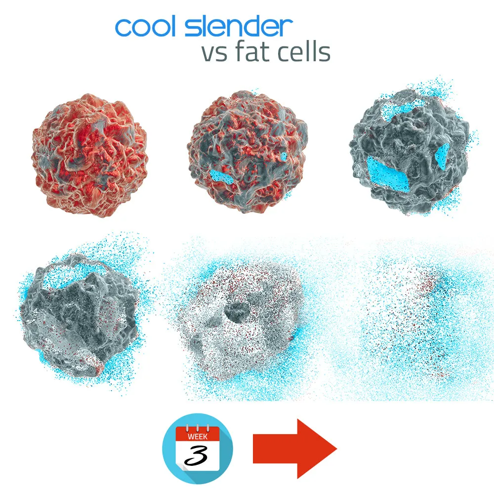 Cool Slender™ Fat Freezing System